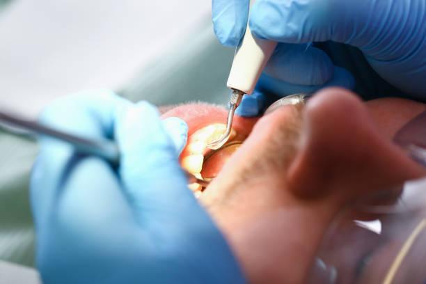 Best Holiday Emergency Dentist in Concord, CA