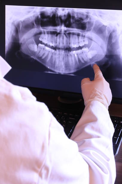 Best Emergency Dentist for Knocked-Out Tooth in Concord, CA