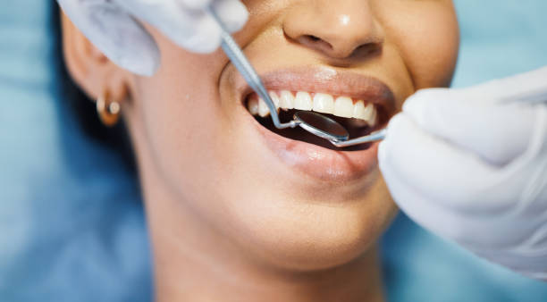Best Pediatric Emergency Dentist in Concord, CA