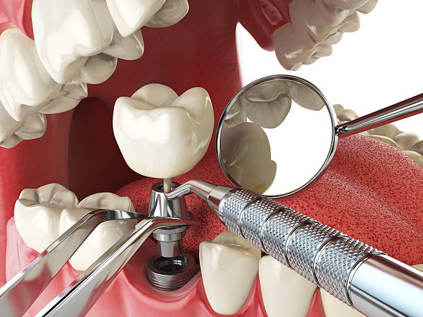 Best Holiday Emergency Dentist in Concord, CA